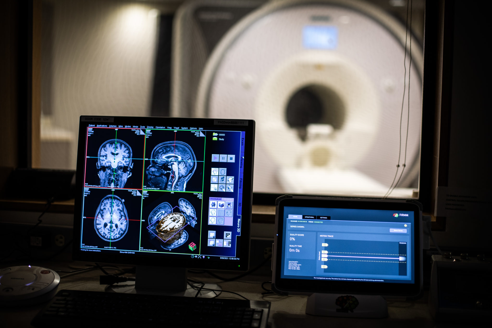 Brain Cancer Detection
